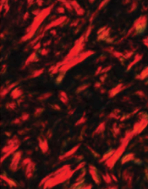 RED : Old Collagen