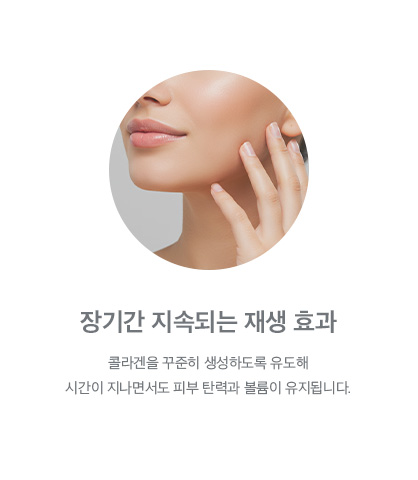 장기간 지속되는 재생 효과